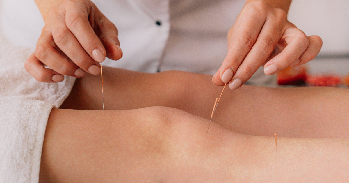 acupuncturist in calgary nw