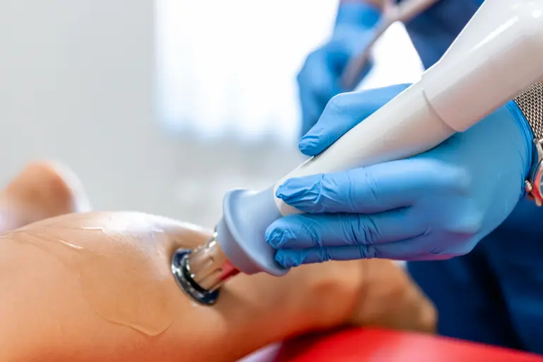 Shockwave treatment in NW Calgary for chronic tendon pain
